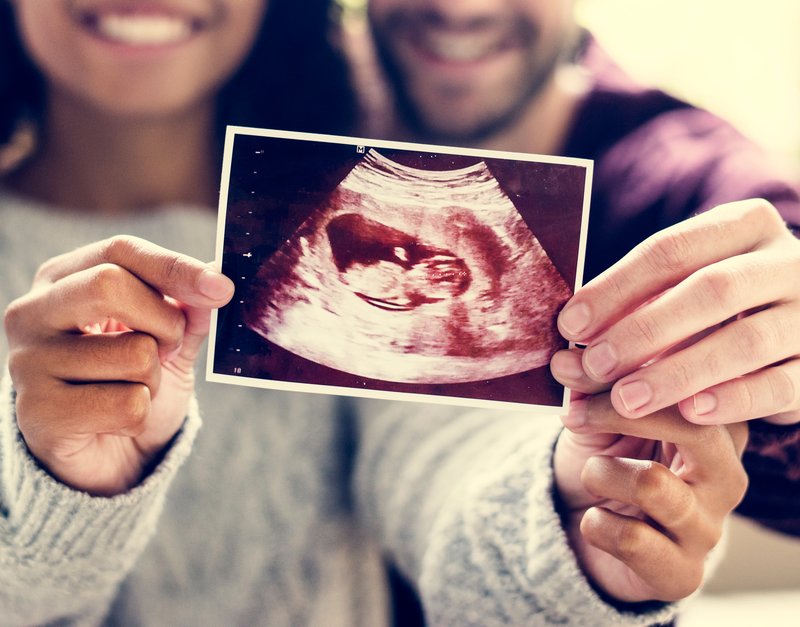 Couple holding baby scan image in foreground